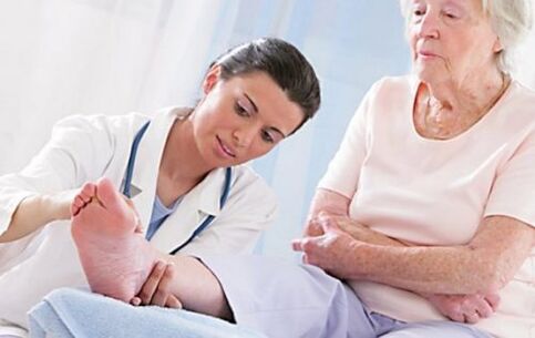 Consultar um médico se tiver sintomas de varizes